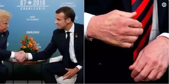 特朗普被“握手杀”；林俊杰演唱会裤子掉了，NARS请*毒涉**艺人站台