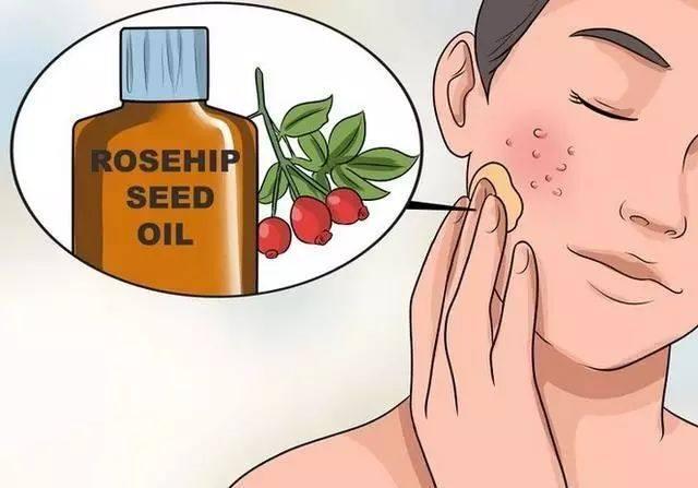 让毛孔变小最快的方法学生,让毛孔变小用什么药