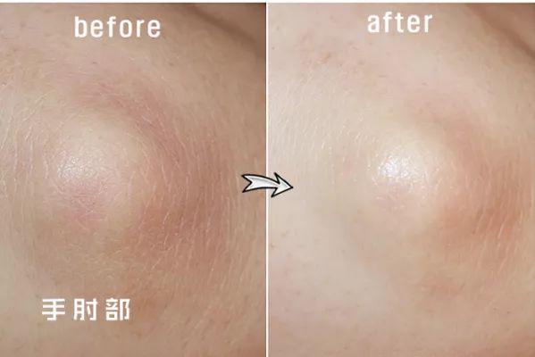 擦掉一张皮，双脚换皮术！死皮、老茧一喷就没，15秒还原嫩白玉足！