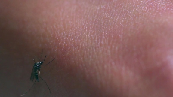 这个吻,竟然致命