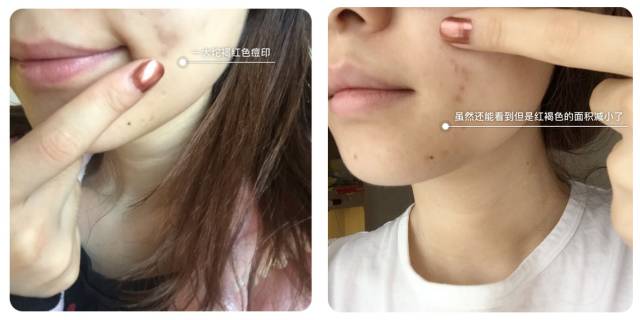 科颜氏美白精华和倩碧美白精华,雅诗兰黛美白精华和美白淡斑精华