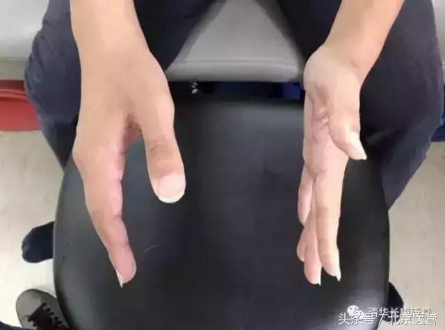 世界杯运动员受伤怎么处理,世界杯球员受伤对方球员赔偿吗