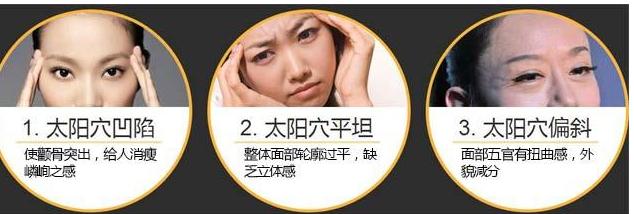 太阳穴填充需要注意什么才能更美,太阳穴填充怎么才能填得高级