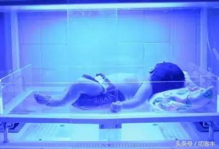 新生儿溶血检测报告单,母亲o型血新生儿溶血