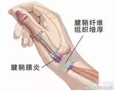 核桃手串有裂痕盘玩久了会愈合吗,核桃手串怎么避免上当