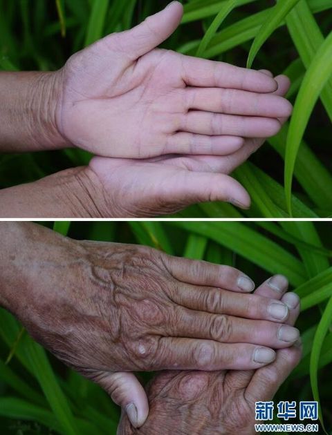 全国造林模范张莲莲,张莲莲植树造林的事迹