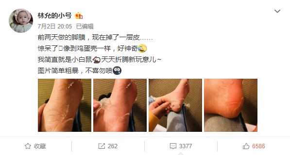 林允回应撕脚皮事件,林允撕脚皮用的是什么