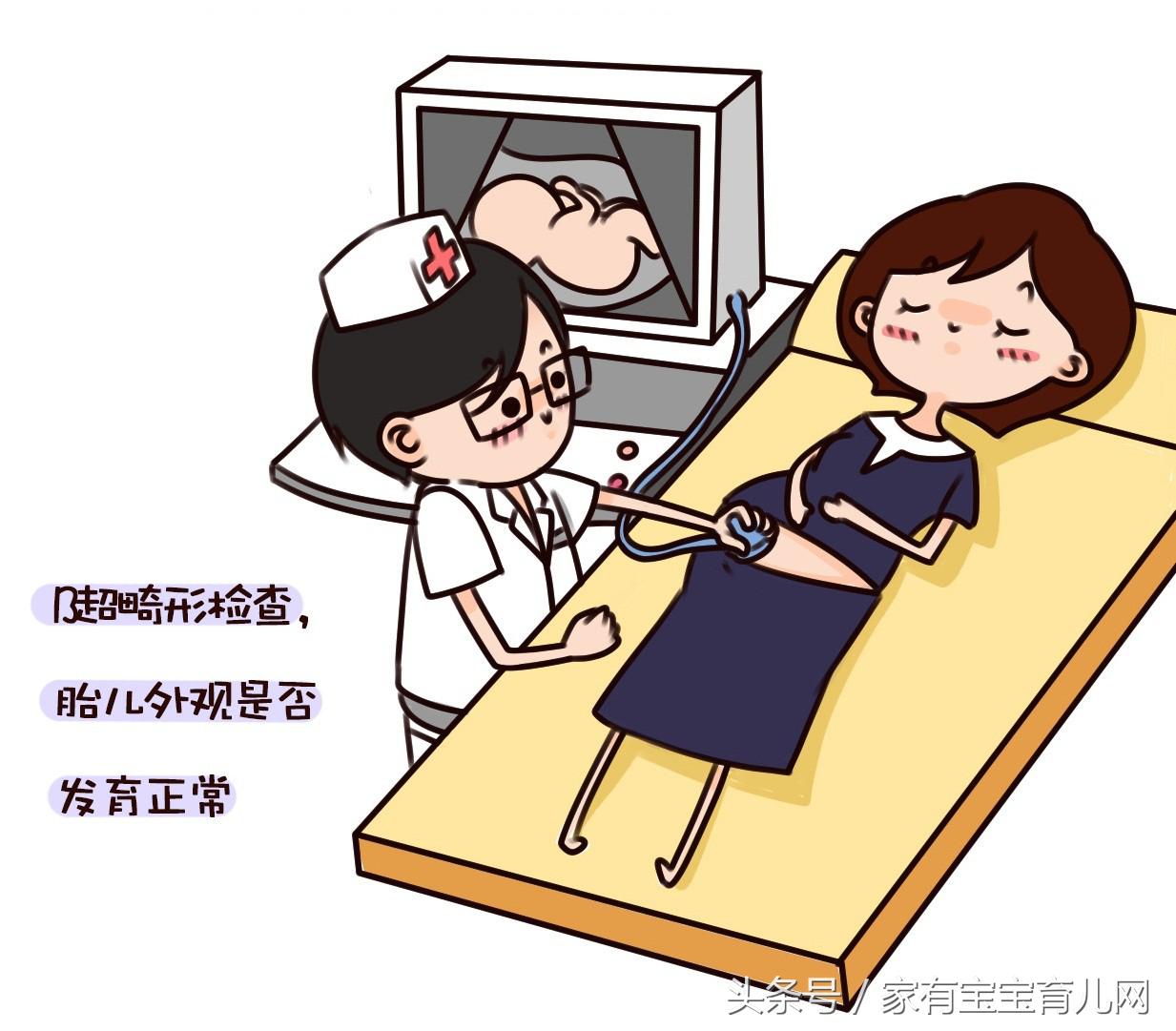 最全的产检时间表和项目唐氏,产检唐筛检查流程