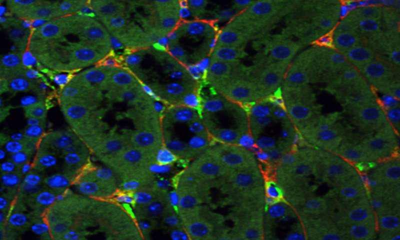 向前迈出的重要一步，为肾病患者开发了基因治疗方法