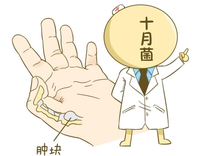 腱鞘炎千万别手术知乎,腱鞘炎妈妈手千万别硬撑