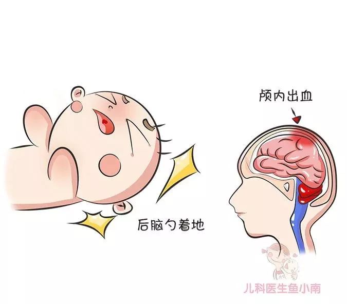 宝宝后脑勺着地会头皮痒吗,宝宝后脑着地会摔傻吗