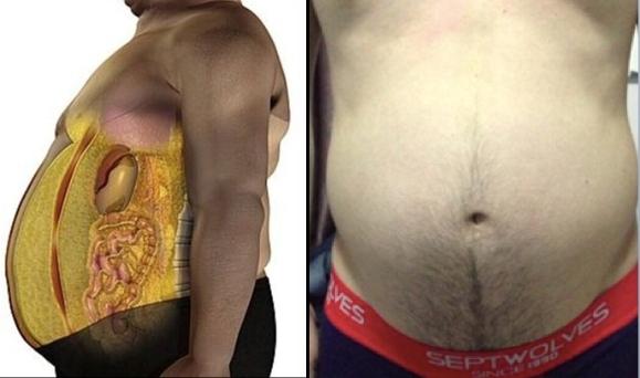 空腹原地做100下减掉内脏脂肪,减掉内脏脂肪只需要这三招