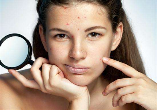 痘印反反复复去不掉,痘印一直去不掉