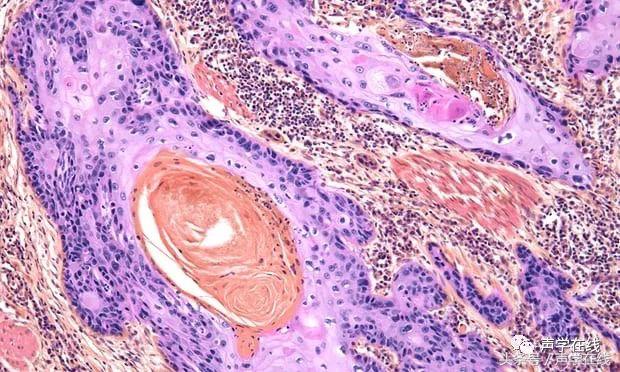 ai能战胜癌症吗,我不是药神惹怒众多癌症患者