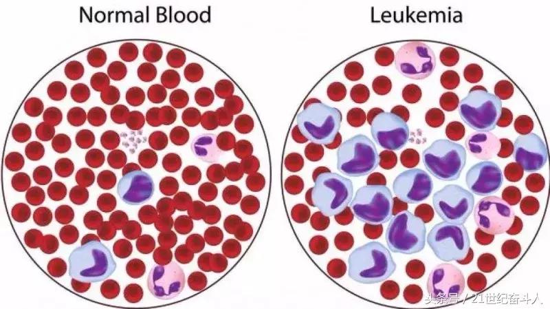 《我不是药神》中的正版格列宁凭什么卖这么贵?