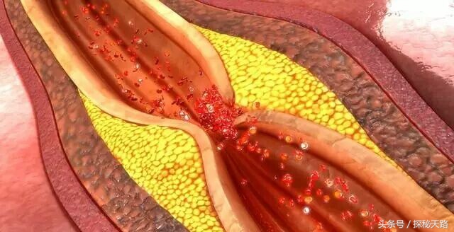 45―59岁为“生命高危期”，“三防”“三戒”指什么？