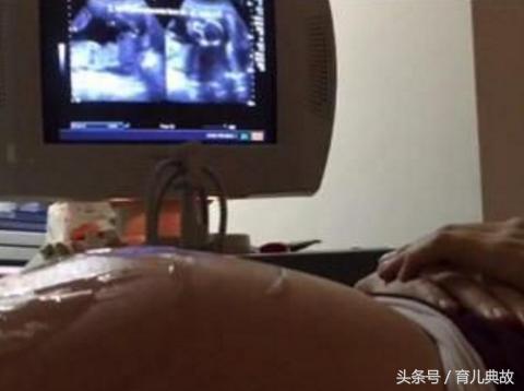 怀孕8个月肚子突然“变硬”，孕妈哭的稀里哗啦，医生却无奈了