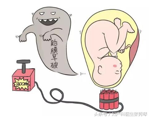 胎膜早破几小时用抗生素,40周胎膜早破多久能生