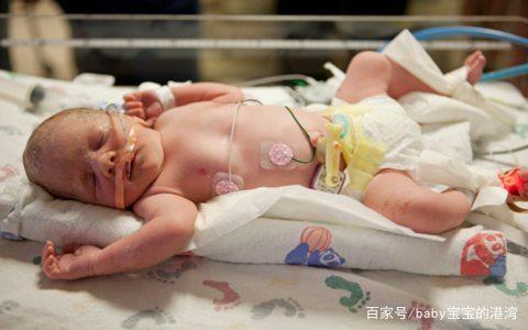 早产儿预防脑瘫最有效的方法,预防早产儿脑瘫最有效的方法