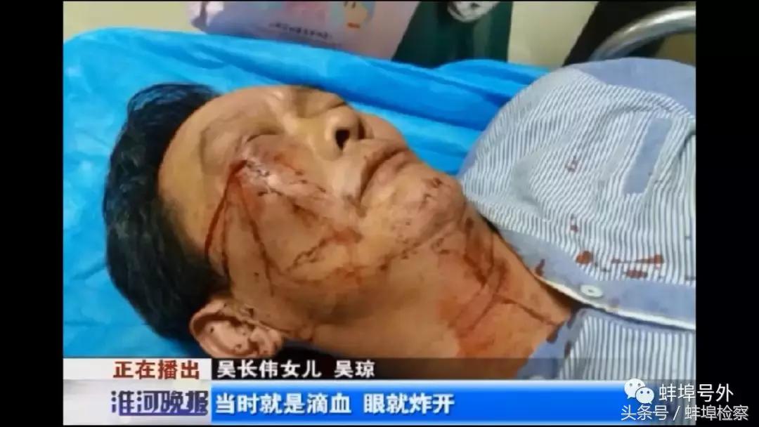 「冲动」蚌埠一老人因拒收快递，竟被“快递员”打掉牙齿，打成脑震荡！