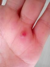 玻璃钢毛刺扎手怎么处理,玻璃丝扎手怎么解决