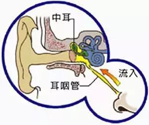 成人急性中耳炎流脓怎么处理,急性中耳炎耳朵流脓怎么暂时解决