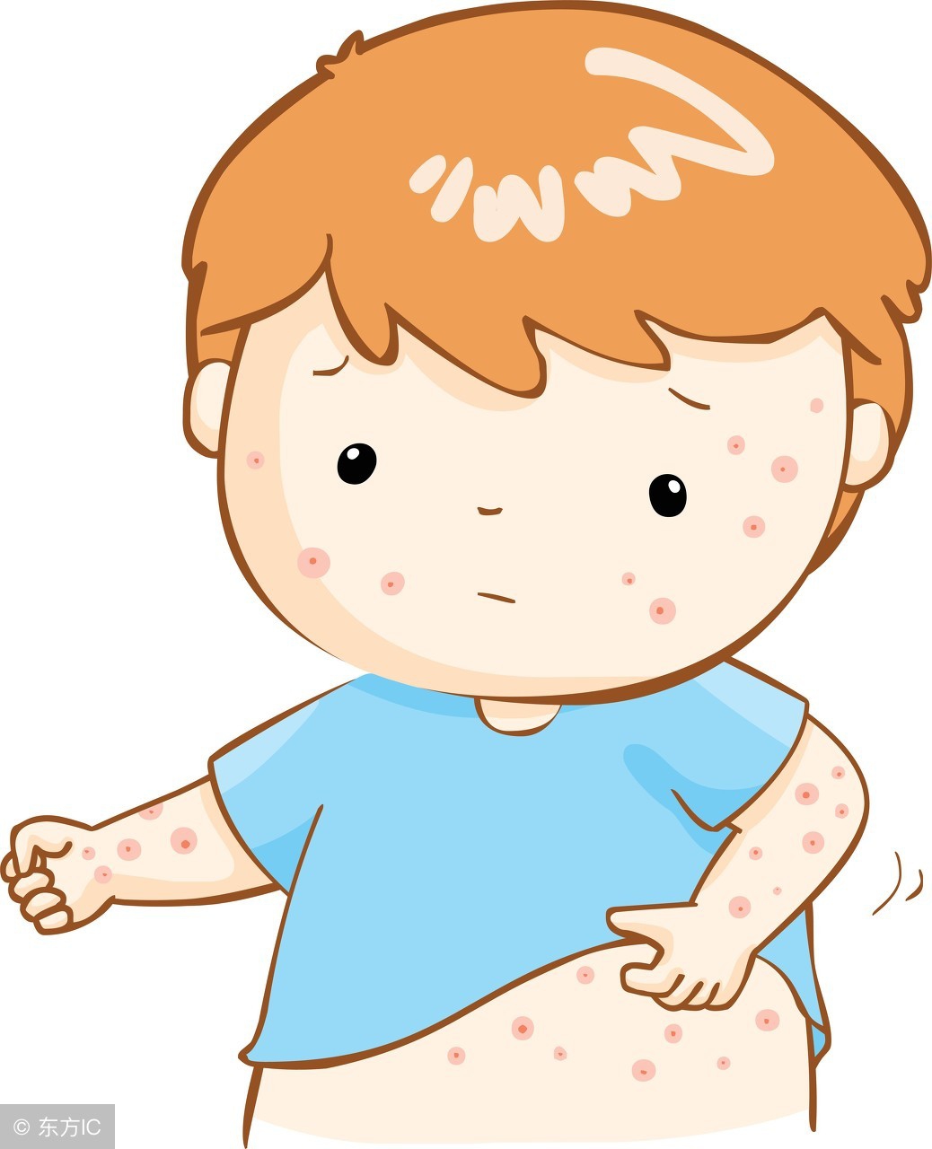 阴囊湿疹夏季高发,3个小方法让你不在害怕它