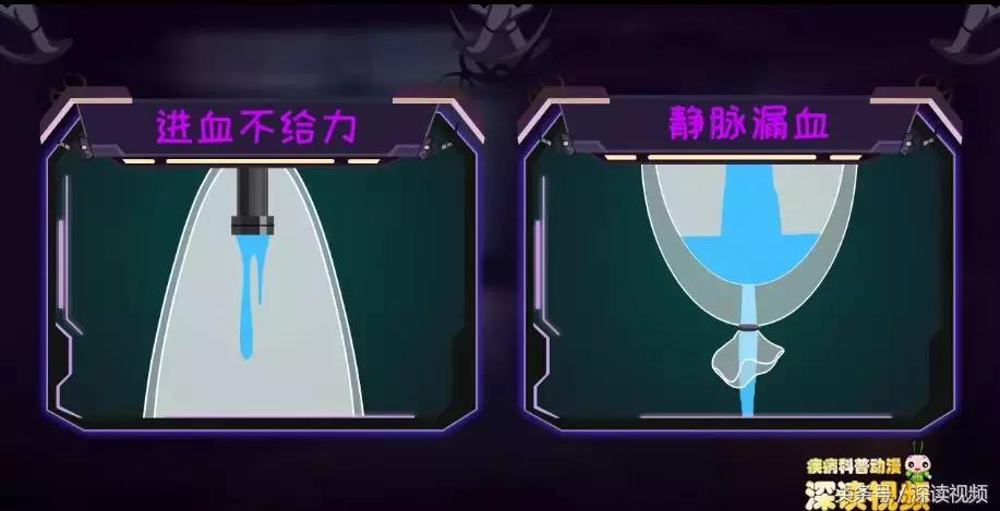 谁让你“兄弟”不给力,谁让你“痿”靡不振?阳痿诱发因素知多少