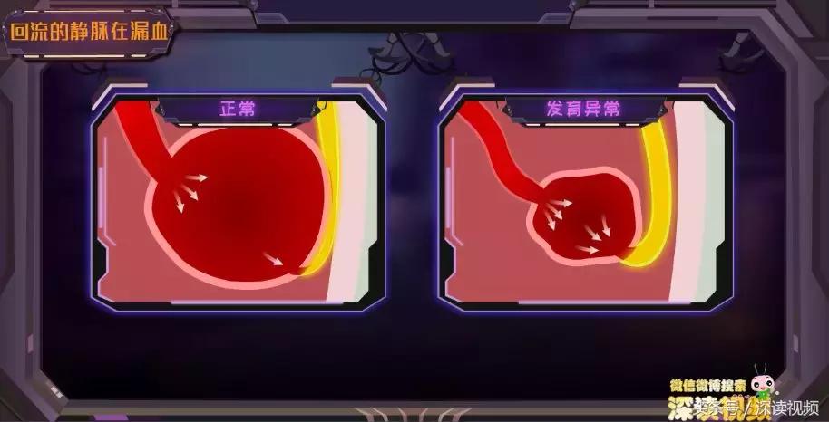 谁让你“兄弟”不给力，谁让你“痿”靡不振？阳痿诱发因素知多少