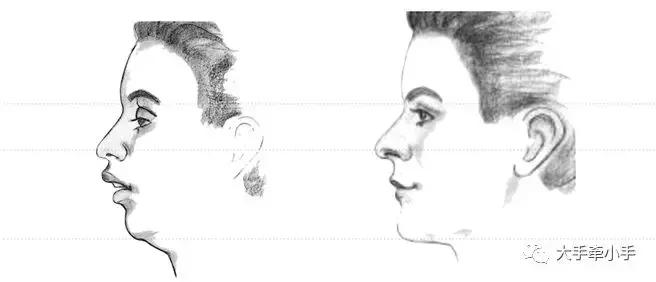 牙齿不齐矫正好还是做牙冠好,牙齿不齐矫正1个月的变化