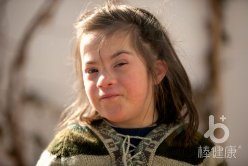 唐氏儿童长大后没有生育能力吗,唐氏综合征的孩子有生育能力吗