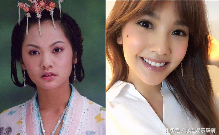 女明星的发际线高的是怎么回事,额头发际线高很难看怎么办