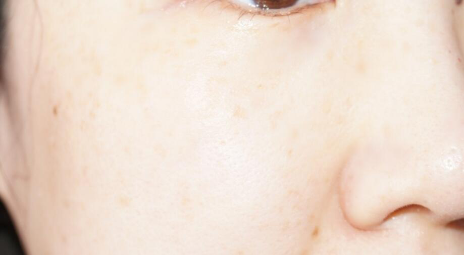 贝德玛卸妆水500ml和500g的区别 (bioderma贝德玛大瓶卸妆水怎么开)