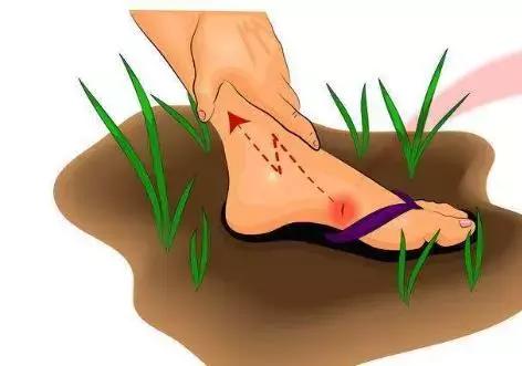 伤口在哪种情况下容易感染破伤风,预防破伤风需要对伤口如何处理