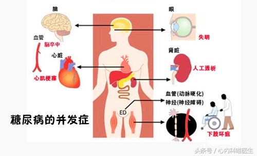 老年人血糖空腹10怎么调理,老年人空腹7.5血糖算高吗