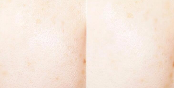 城野医生毛孔细致化妆水搭配精华,城野医生化妆水适合油皮