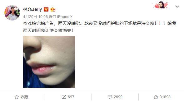 林允保养法令纹视频,林允法令纹