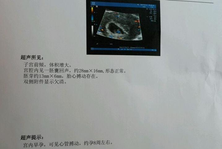 孕早期见红该不该告诉老公,孕早期会见红吗一般在什么时候