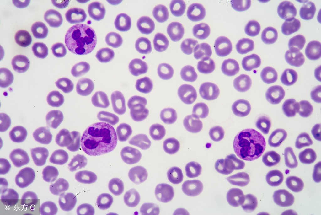 化疗导致白细胞低吃什么食物好呢,化疗期间白细胞低吃什么食物好