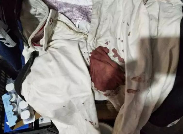 看着都疼男子卸货摔倒,看着都疼系列惊险一幕