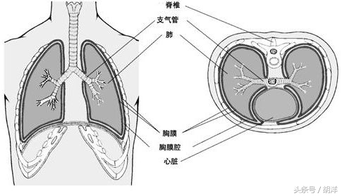 结核性胸膜炎能不能根治,结核性胸膜炎怎么导致的