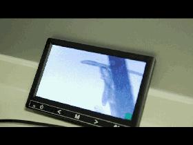 眼睛有螨虫的干眼怎么治疗,螨虫眼治疗视频