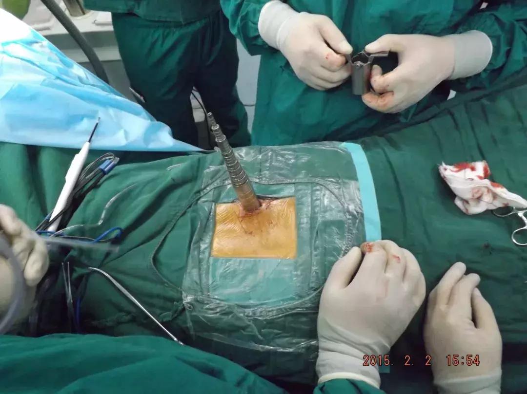 邯郸峰峰集团总医院邯郸分院,邯郸峰峰骨科医院电话