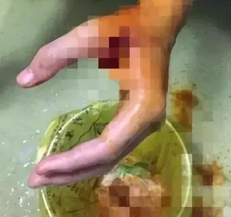 可乐打开方法,可乐为什么禁止零度以下冷冻