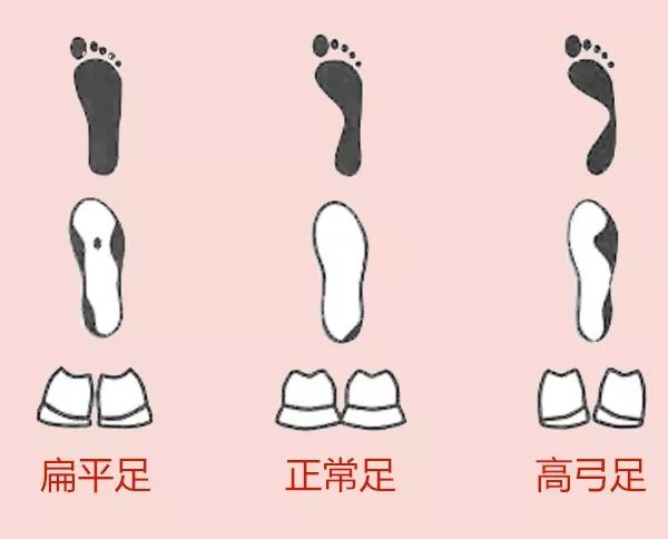 鞋底往外磨斜怎么回事,右脚鞋底外侧磨得严重是什么原因