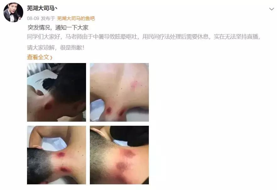 大司马直播中暑,大司马早期热到中暑