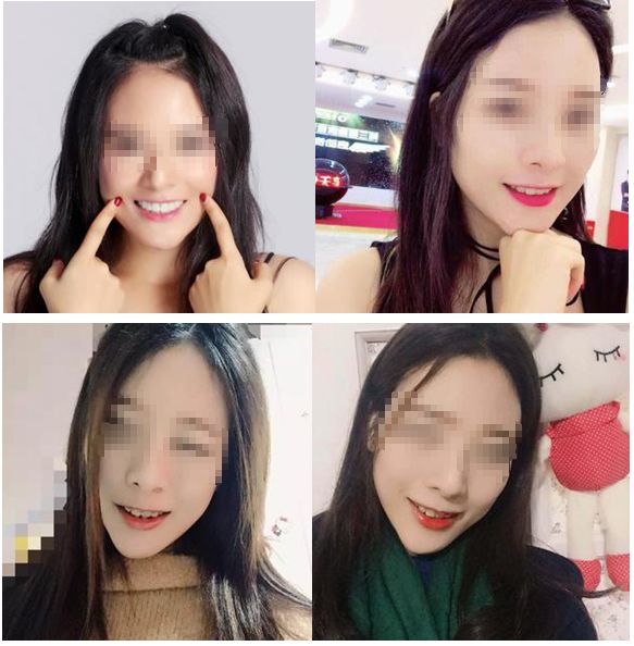 种植牙能降价多少钱啊,牙齿种植牙价格一览表