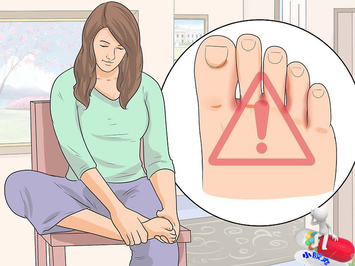 还在为脚臭而发愁吗,这些秘方帮您攻克顽固脚气