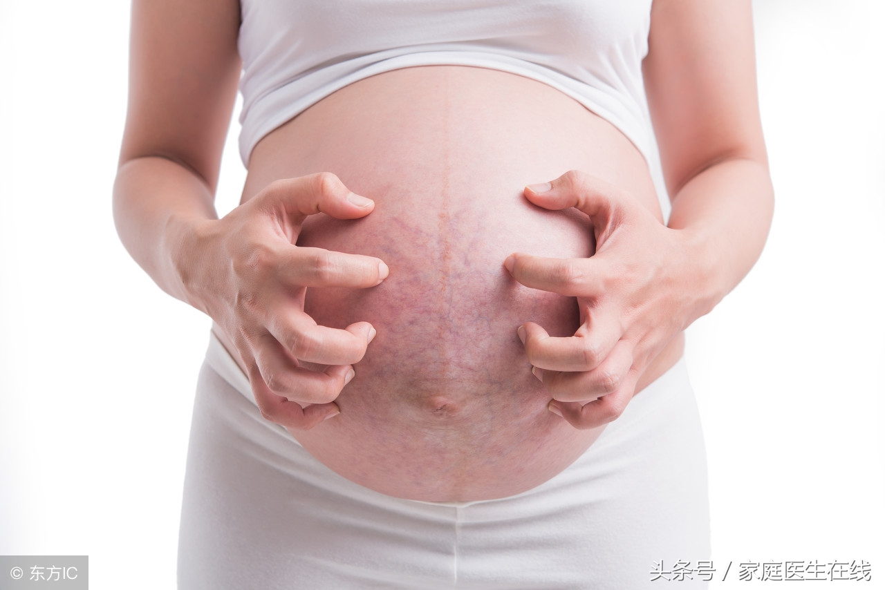 胸上长妊娠纹是什么原因,什么样的孕妈容易长妊娠纹