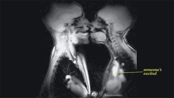 *交性**后烦躁症（PCD）是怎么回事？